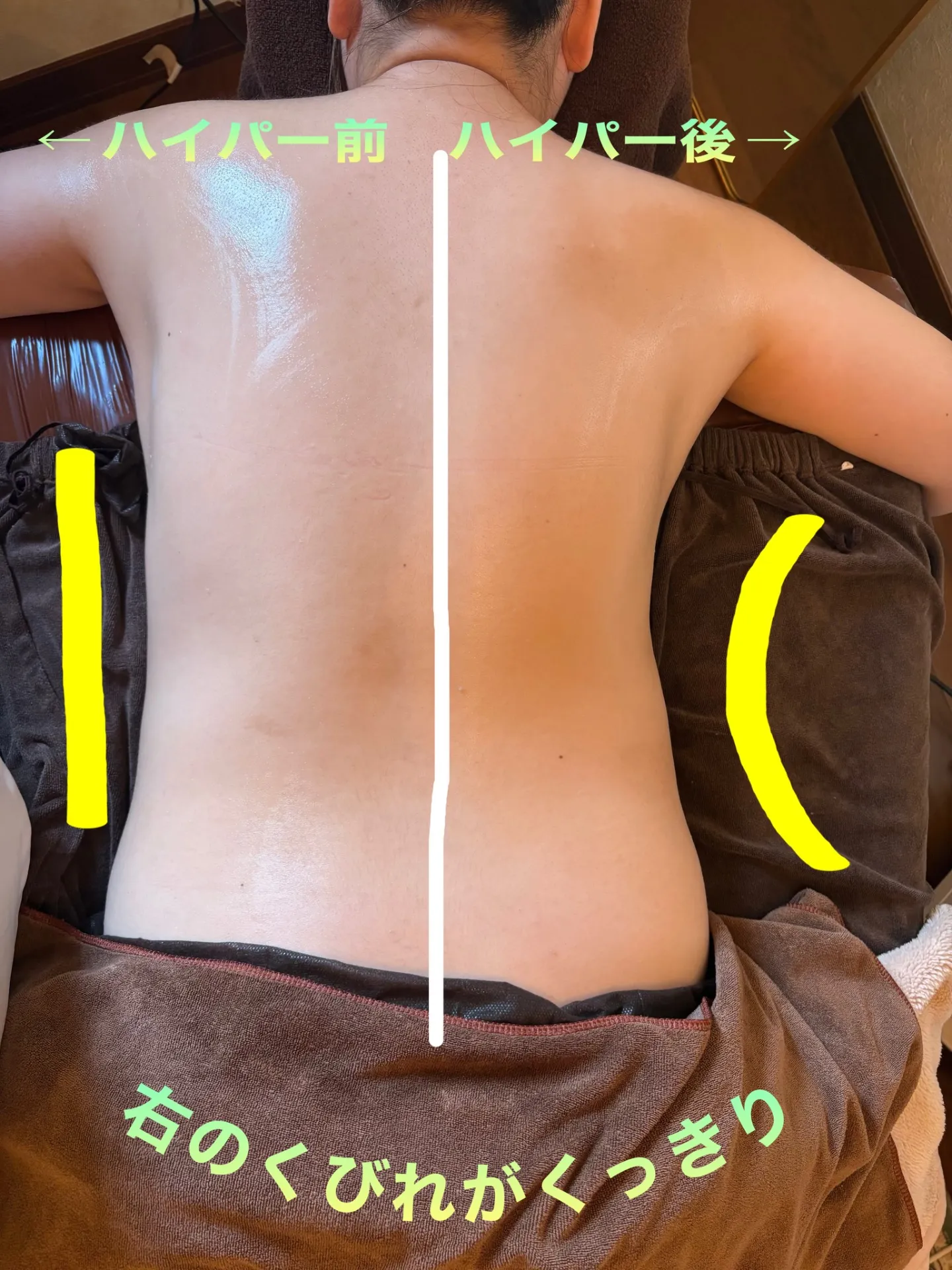 ハイパーナイフで速攻くびれ